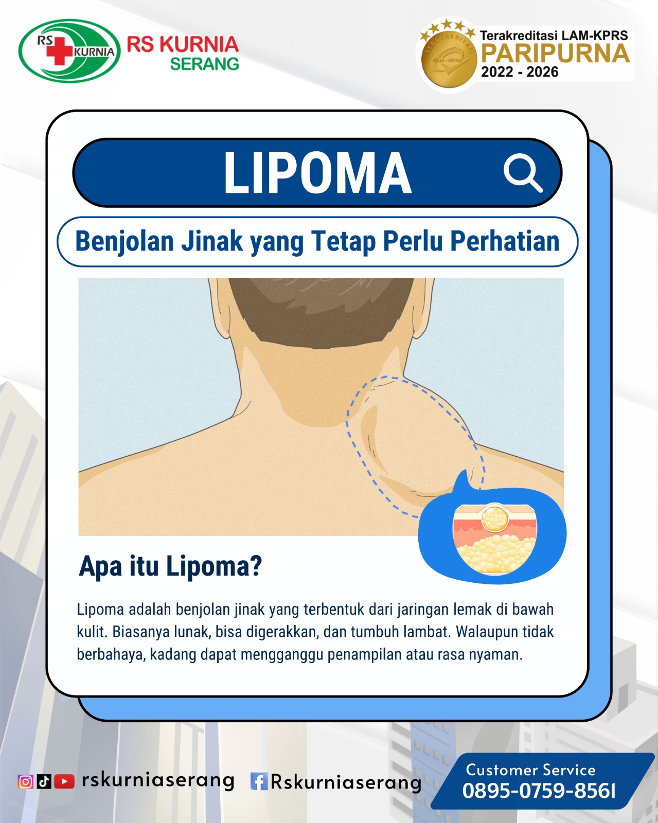 LIPOMA : BENJOLAN JINAK YANG TETAP PERLU PERHATIAN